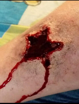 An photo of Sfx makeup. A large open star shaped wound.